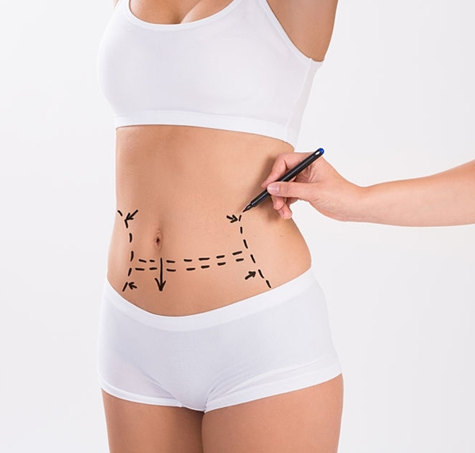 best tummy tuck surgeon in turkey