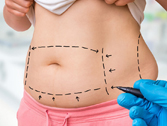 tummy tuck price turkey