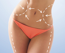 liposuction izmir turkey